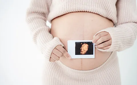 Obstetric Care